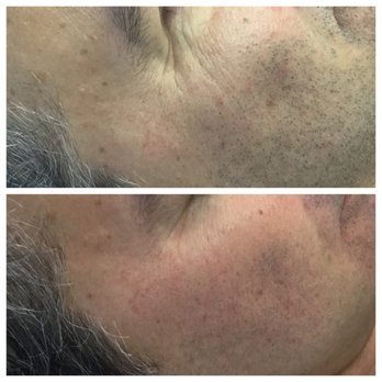 Laser Options By Jen - Medical Spas Near Me - Scottsdale, Arizona Laser Options By Jen - Medical Spas Near Me - Scottsdale, Arizona