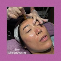 Helen's Haven - Elite Microneedle, Microneedling