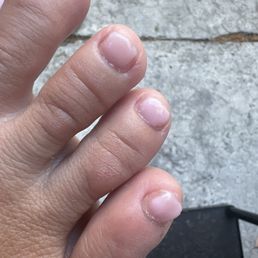 My toe nail isnt painted??? It's like missing a huge chunk? My toe nail isnt painted??? It's like missing a huge chunk?