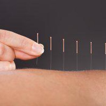 Lisa Meyerson Acupuncture - Acupuncture Near Me - Evanston, Illinois Lisa Meyerson Acupuncture - Acupuncture Near Me - Evanston, Illinois