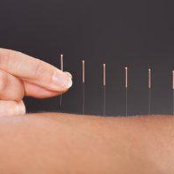 Lisa Meyerson Acupuncture