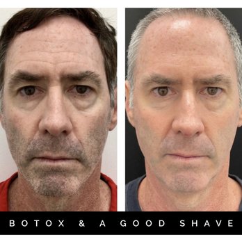 DermaSpalogy | Best Facials Miami | Botox Medspa Miami - Take years off with Botox. - Medical Spas Near Me - Pinecrest, Florida