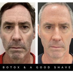 DermaSpalogy | Best Facials Miami | Botox Medspa Miami - Take years off with Botox.