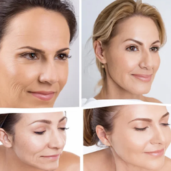 Nouveau Aesthetics - Microneedling is a minimally invasive cosmetic procedure that involves the use of fine needles to create tiny punctures in the skin