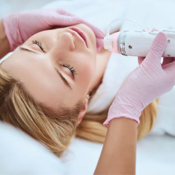 Galil Med Spa - Microneedling treatment designed to stimulate collagen, smooth fine lines, and improve overall skin texture. - Skin Care Near Me - Eagle, Idaho
