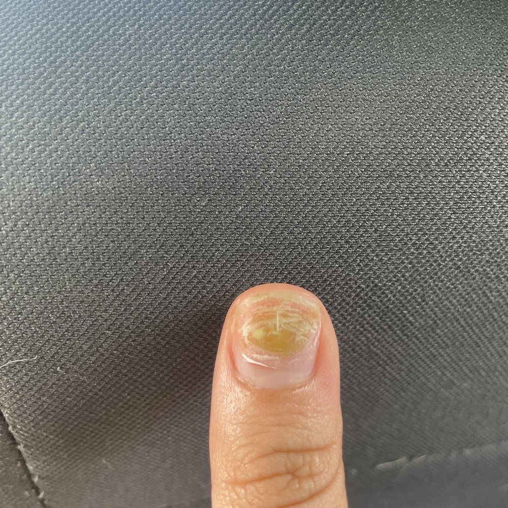 Right thumb Right thumb