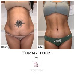 Dev Wali, MD Plastic Surgery-Medspa