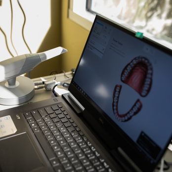 Andrew I Softley, DDS - Softley Dental - We use top of the line 3D scanning technology for your comfort and convenience. - Cosmetic Dentists Near Me - San Marcos, California Andrew I Softley, DDS - Softley Dental - We use top of the line 3D scanning technology for your comfort and convenience. - Cosmetic Dentists Near Me - San Marcos, California