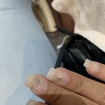Luxury Nail Spa - Infected nail - Nail Salons Near Me - Pinole, California Luxury Nail Spa - Infected nail - Nail Salons Near Me - Pinole, California