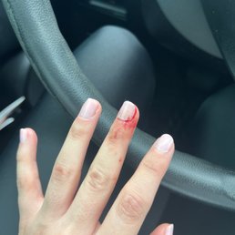 Cuticle bleeding. Kind of painful