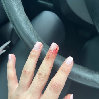 B & Y Nails Spa - Cuticle bleeding. Kind of painful - Nail Salons Near Me - Austin, Texas