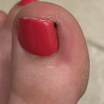 Le's Nails & Waxing - My big toe - Nail Salons Near Me - Phoenix, Arizona