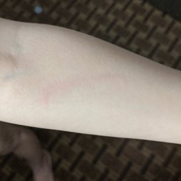Red mark from the mouse trap