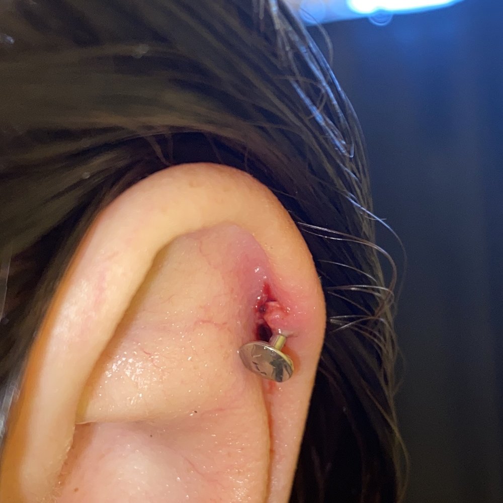 Skin Lab Tattoo & Body Piercing - Updated photo: Morning after piercing was done immediately following a shower. - Tattoo Near Me - Tempe, Arizona Skin Lab Tattoo & Body Piercing - Updated photo: Morning after piercing was done immediately following a shower. - Tattoo Near Me - Tempe, Arizona