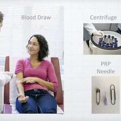 PRP Hair Loss Treatment Center
