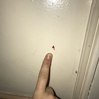 Alpine Motel - Even more blood on the wall! Ewww! - Hotels Near Me - Smithfield, Rhode Island Alpine Motel - Even more blood on the wall! Ewww! - Hotels Near Me - Smithfield, Rhode Island
