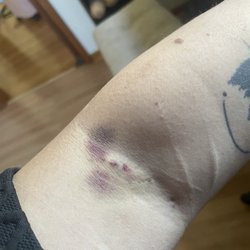 KEDPLASMA - Day 4