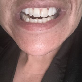 Phoenix Comprehensive Dentistry - Cosmetic Dentists Near Me - Phoenix, Arizona Phoenix Comprehensive Dentistry - Cosmetic Dentists Near Me - Phoenix, Arizona