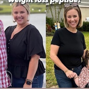 Amason Aesthetics - Medical Spas Near Me - Saint Johns, Florida Amason Aesthetics - Medical Spas Near Me - Saint Johns, Florida