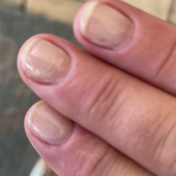 Luxury Nail Bar - Visible dremel marks under gel and black polish on clear nail. - Nail Salons Near Me - Revere, Massachusetts Luxury Nail Bar - Visible dremel marks under gel and black polish on clear nail. - Nail Salons Near Me - Revere, Massachusetts