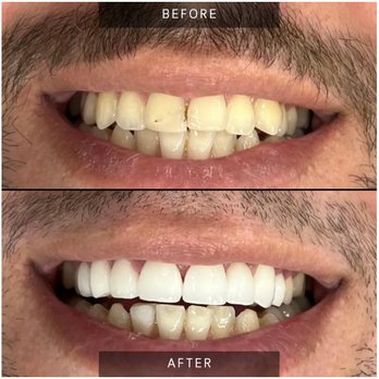 Just Dental - General Dentistry Near Me - Westminster, California Just Dental - General Dentistry Near Me - Westminster, California