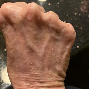 Glo Medspa - This is the end result. Truly amazing - Medical Spas Near Me - Scottsdale, Arizona Glo Medspa - This is the end result. Truly amazing - Medical Spas Near Me - Scottsdale, Arizona