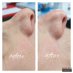 Visible Difference - Hydraderm Vital Energy will deep cleanse the skin leaving it hydrated and glowing after a single treatment