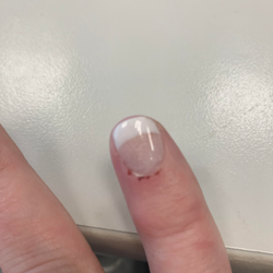 M & B Nails - Bloody finger from manicure (this is 2 days after!)