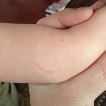 Busy Bees Chandler Child Care Center - The bite marks claimed my son didn't cry about. Um, this would make me cry! - Preschools Near Me - Chandler, Arizona Busy Bees Chandler Child Care Center - The bite marks claimed my son didn't cry about. Um, this would make me cry! - Preschools Near Me - Chandler, Arizona