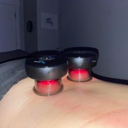 Savasana Massage & Body - Cupping released my lower backache.