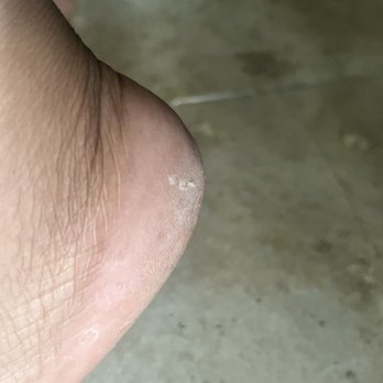 Nail Affair Salon - My foot after pay $186 for the special. AFTER SMH - Nail Salons Near Me - Sherman Oaks, California