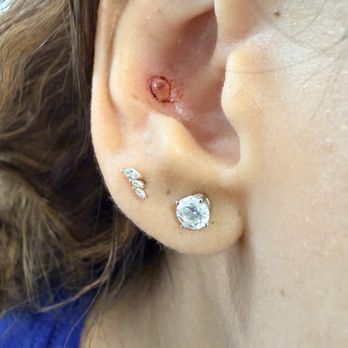 Stay True Body Piercing - Second line piercing placement and right after getting the retainer put in for the MRI. - Piercing Near Me - Newington, Connecticut Stay True Body Piercing - Second line piercing placement and right after getting the retainer put in for the MRI. - Piercing Near Me - Newington, Connecticut