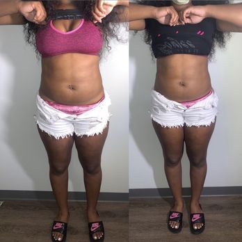 Embodied Beauti - Lipo Cavitation - Skin Care Near Me - Charlotte, North Carolina Embodied Beauti - Lipo Cavitation - Skin Care Near Me - Charlotte, North Carolina