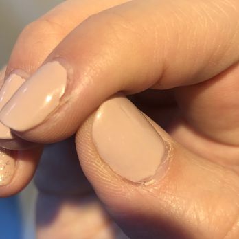 Allure Nail Spa - Peeling after 4 days - Nail Salons Near Me - Chicago, Illinois