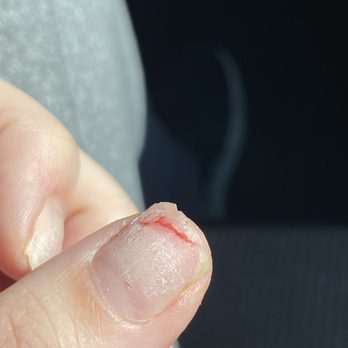 Top Nails - PAINFUL - Nail Salons Near Me - Chicago, Illinois
