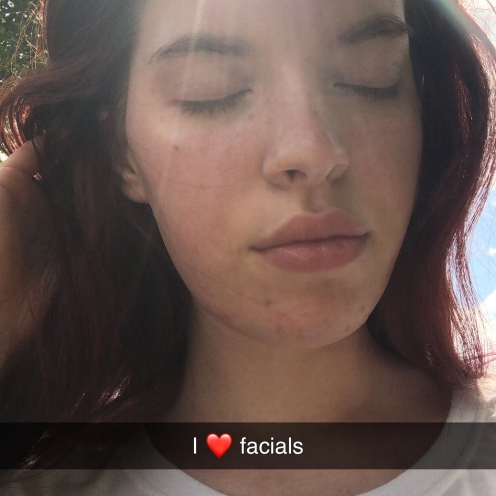 LaBella Skinbar - My skin in natural sunlight after an acne facial! - Waxing Near Me - Germantown, Tennessee LaBella Skinbar - My skin in natural sunlight after an acne facial! - Waxing Near Me - Germantown, Tennessee