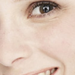 Creative Smiles