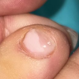 The shiny top half is gel top coat The shiny top half is gel top coat