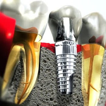 Joseph Lee, DDS - Mountain View Family & Cosmetic Dentistry - Joseph Lee, DDS (Mountain View Family & Cosmetic Dentistry) Cosmetic Dentist - Cosmetic Dentists Near Me - Mountain View, California