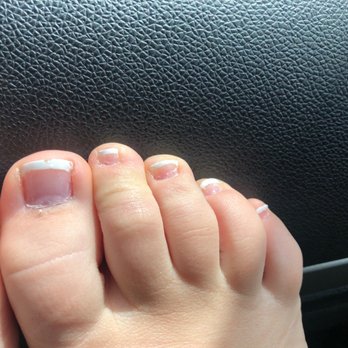 LV Nails - French tip pedicure - you can see they are already chipping. - Nail Salons Near Me - Osage Beach, Missouri