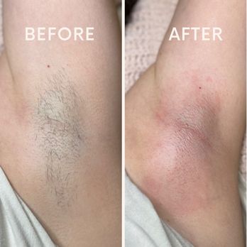Rejuvenating Beauty with Cassie - Underarm waxing - Estheticians Near Me - Rocklin, California Rejuvenating Beauty with Cassie - Underarm waxing - Estheticians Near Me - Rocklin, California