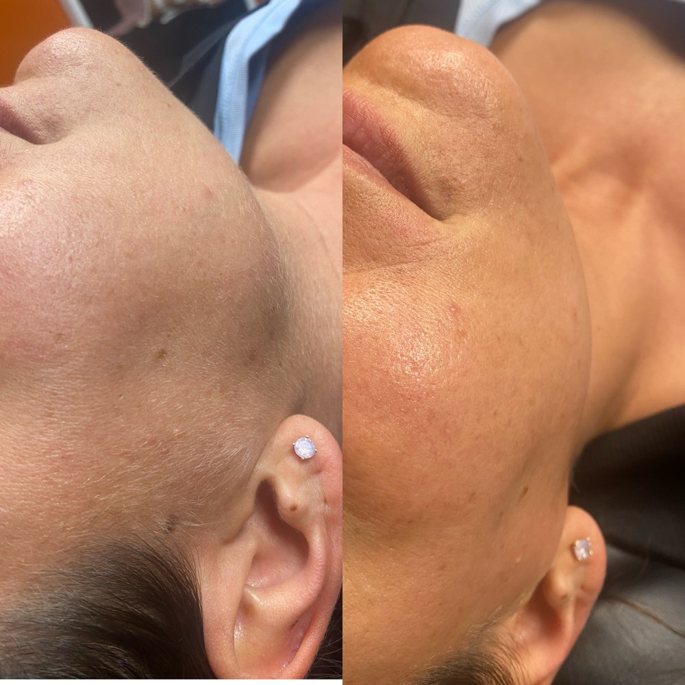 Everskin Esthetics Logo