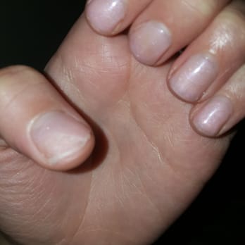 VIP Nail Salon - Got a gel manicure done 6 days ago and already chipping and coming off. Very disappointed ! - Nail Salons Near Me - Hanover, Maryland VIP Nail Salon - Got a gel manicure done 6 days ago and already chipping and coming off. Very disappointed ! - Nail Salons Near Me - Hanover, Maryland
