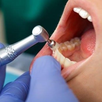 East Grove Dental - General Dentistry Near Me - Madison, Wisconsin East Grove Dental - General Dentistry Near Me - Madison, Wisconsin