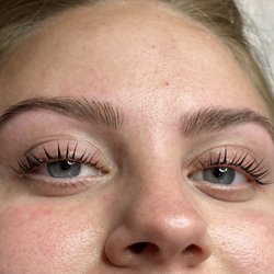Nidhis Skin Care Studio - after