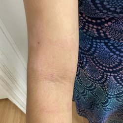 Preston Dermatology + Skin Surgery - May2023