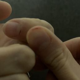 The tech cut my fingers aggressively removing the acrylics. The tech cut my fingers aggressively removing the acrylics.