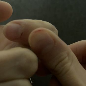 Lee's Spa Nail - The tech cut my fingers aggressively removing the acrylics. - Nail Salons Near Me - Monroe, North Carolina Lee's Spa Nail - The tech cut my fingers aggressively removing the acrylics. - Nail Salons Near Me - Monroe, North Carolina