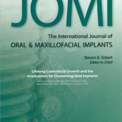 Oded Bahat, BDS, MSD, FACD - Lifelong Craniofacial Growth & Dental Implants, published in JOMI 2013