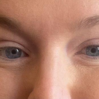 LUXskin - Before - Permanent Makeup Near Me - Carnegie, Pennsylvania